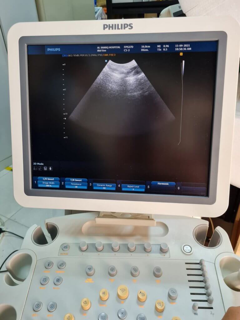 Philips HD9 Ultrasound System (2012) – MedicAmins